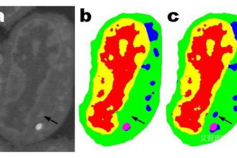 伯克利实验室重大医学AI成果，解决世界上紧迫的科学挑战